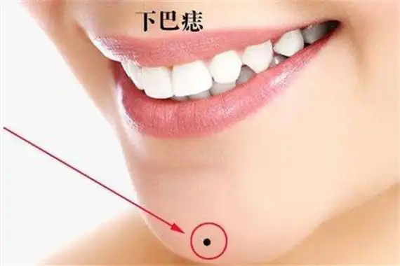 下巴有痣的影响