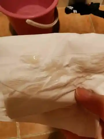 孕9周第一次发现有白带一样的分泌物,正常吗?