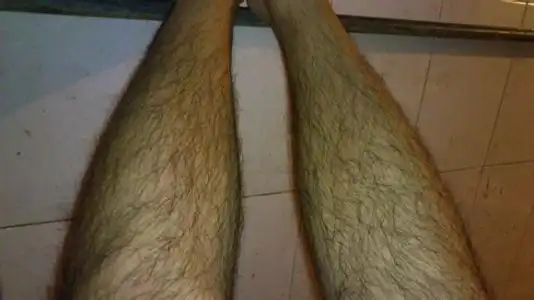 为什么有的男生腿毛浓密有的男生却不多来听听专家的答案