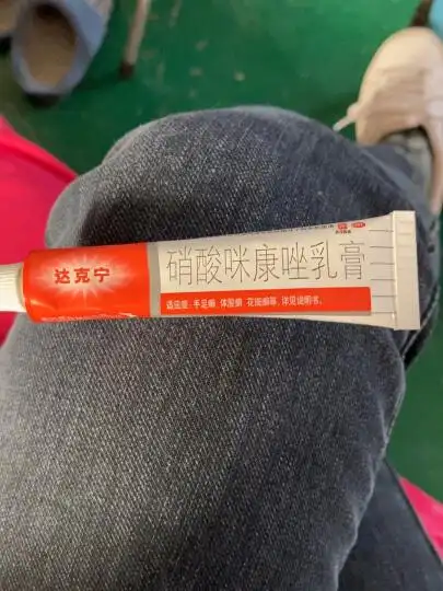 达克宁 硝酸咪康唑软膏乳膏治脚气药20g 去脚气脚臭脚藓脚痒及真菌
