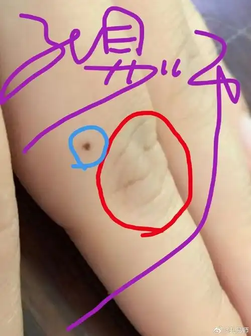 痣相手指背部有痣～～暗地里阻碍多(就是有人使绊子那类!