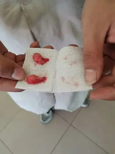 【讨论】那个……想看看大家崽崽绝育割下来的蛋蛋图片(有蛋蛋图慎入)