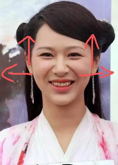 面部肌肉走向问题～_圈子-新氧美容整形