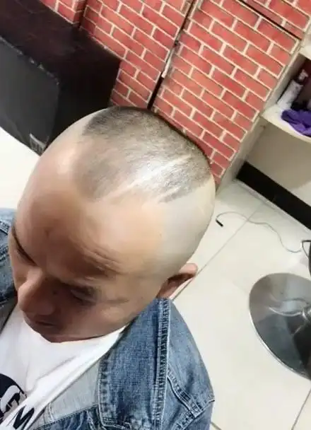 最牛的改变全国5000w秃顶的福音#郭德纲升级版发型