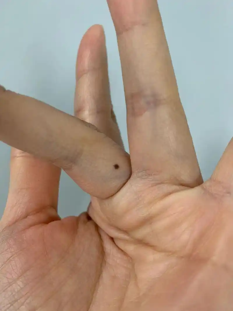 说明有异样吗?有朋友知道吗?