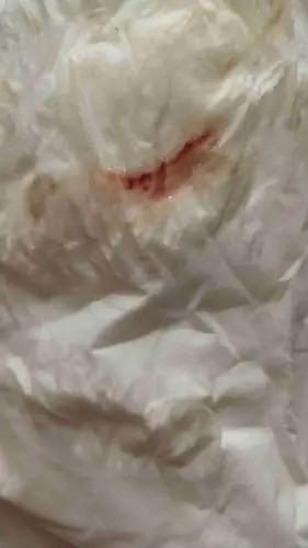 有来一点点 不多 护垫上都没有 只是上厕所的时候有一点 这算是月经吗