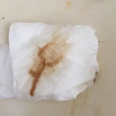 今早起床小便的时候有褐色的东西怕不怕啊_宝宝树