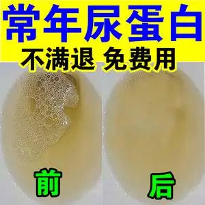 尿液泡沫多尿血检测试纸尿频急许善堂旗舰店感兴趣的产品测荧光剂