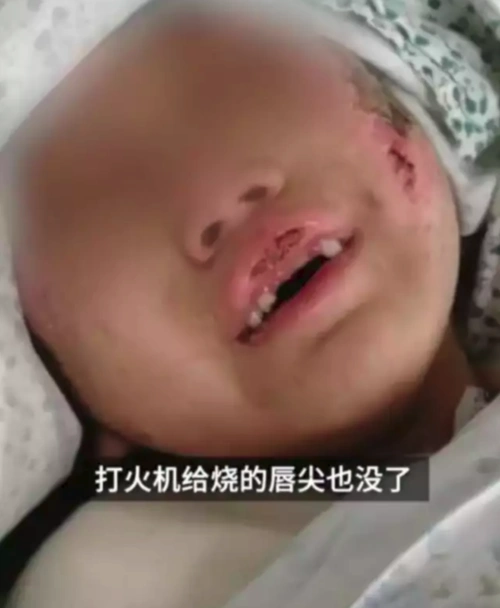 抚顺虐童案你无法想象的残忍虐待