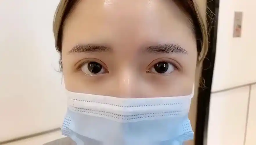 自然款小平行双眼皮,可约同款