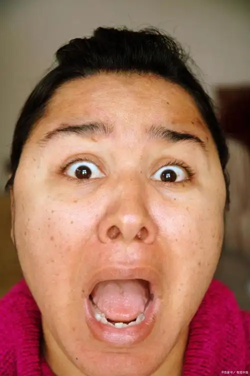 早上起床脸很肿是什么原因导致的?