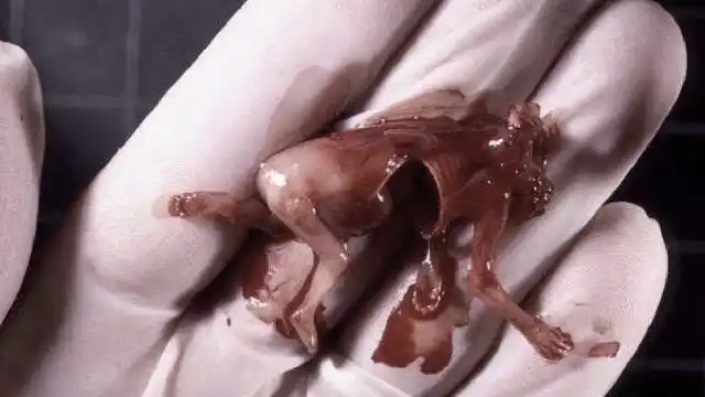 那些还未出生就被引产的胎儿,最后都去了哪里?说出来你不敢信!