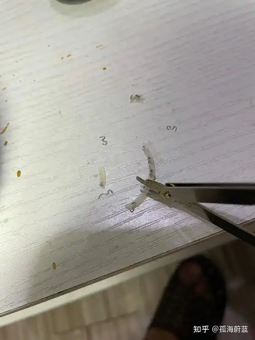 包皮拆钛钉方法