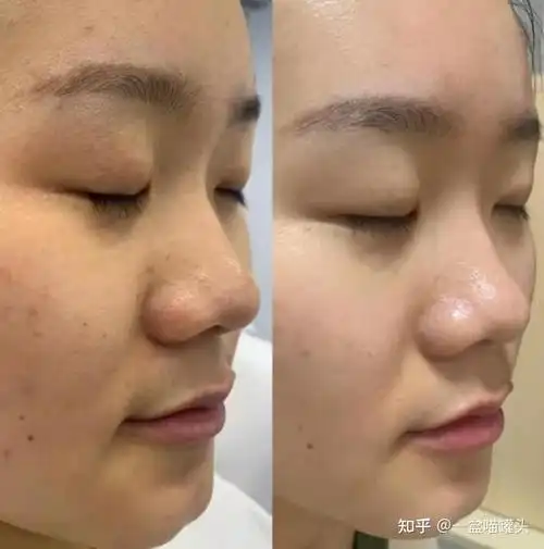 有什么好喝不贵能改善皮肤状态的饮品肤色暗沉喝什么