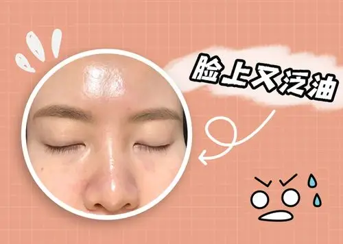 洁面控油用小气泡油腻感消失摆脱大油脸