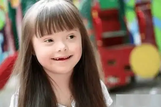 唐氏综合征宝宝的康复办法,主要有哪些?