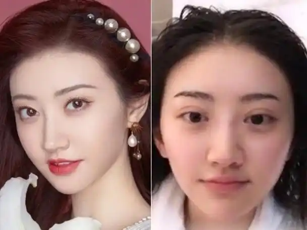 景甜大方承认整容失败,坦言差点抑郁,修复后悲伤蛙变甜心女神