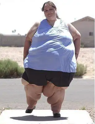 让分布各地的粉丝封她为"超大美女"世界上体重最重的女人苏珊娜·埃曼