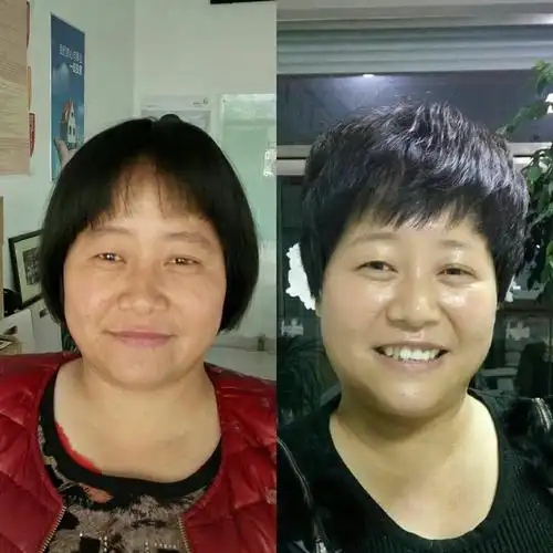 沂源县张家坡镇核桃峪村的李德美女士使用无限极品牌护肤品前后对比.