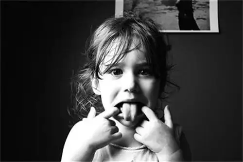 孩子舌尖呈w形当心长成大舌头