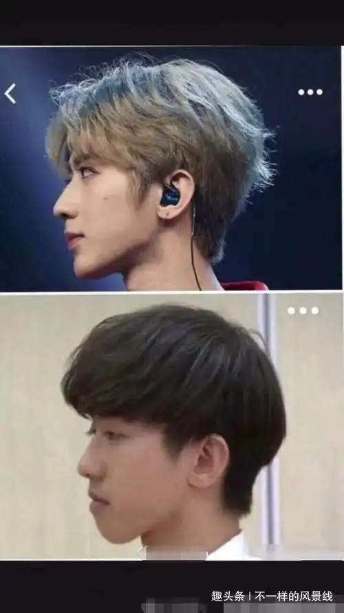 蔡徐坤旧照被扒却引整容风波网友别拿拔牙那一套糊弄我们