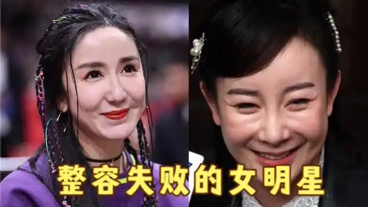 "整容失败"的女明星:张檬取出假体重回巅峰,娄艺潇太可惜了