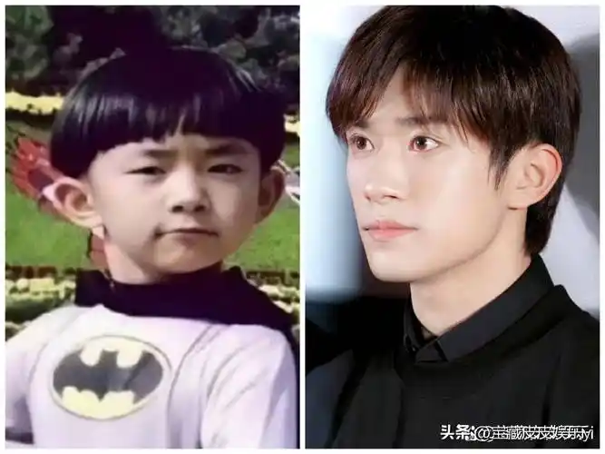 井柏然割双眼皮了?单眼皮帅哥又消失一位?