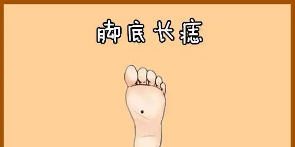 往往拥有此种吉痣的人,也属于巨富命,因为古代的首富"石崇"为命名