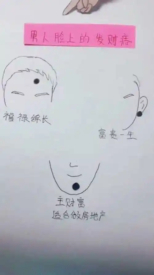 男人脸上的发财痣!