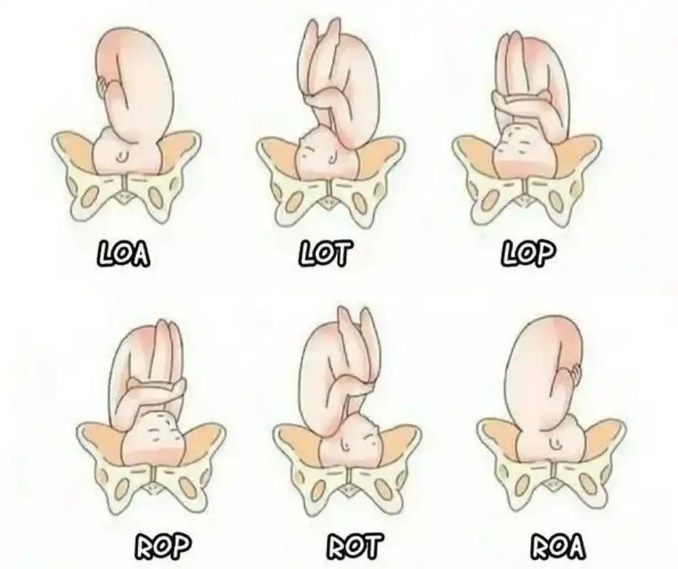 一图看懂胎方位 胎方位是指先露部的指示点与产妇骨盆的关系.