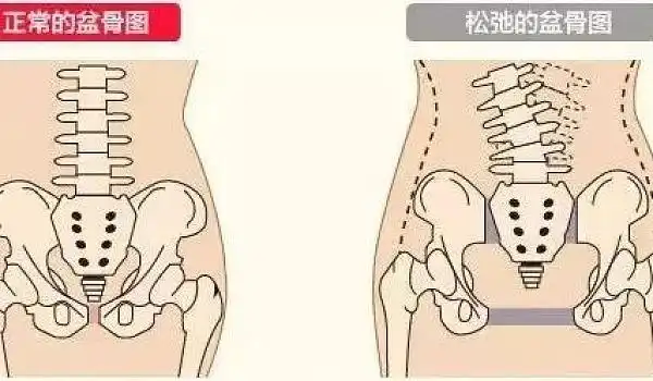 互动吧-并不是骨盆尺寸收了,就是在做骨盆修复了,真相是这样的