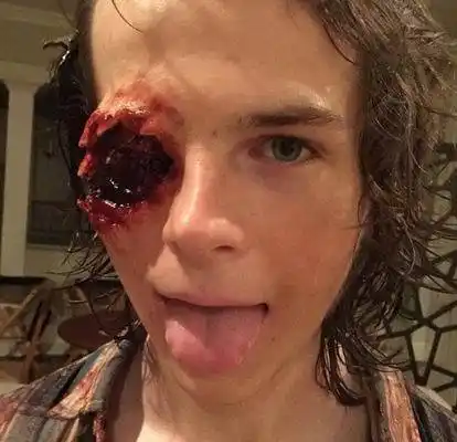 "我们根据钱德勒的造型做了一个假人,并在假人眼睛上制造出了这个伤口