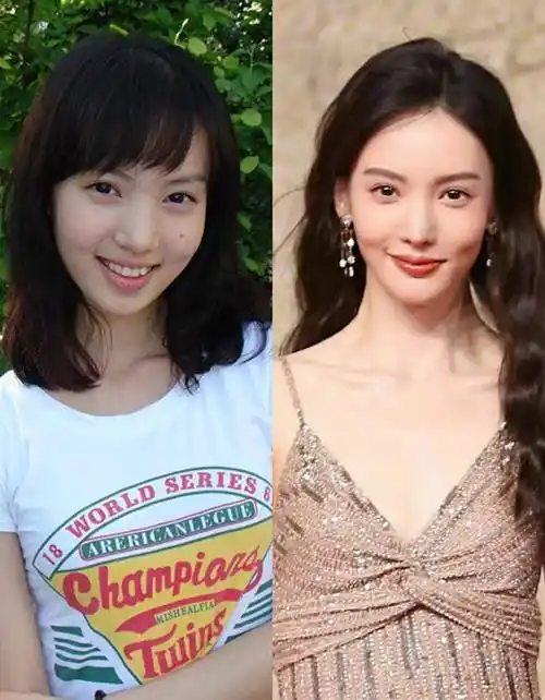 被网暴致"毁容",被骂"整容"上热搜,这些歪嘴女星真的惨_赵明明_金晨