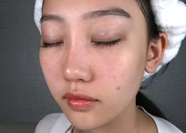 还有这位小姐姐之前相亲多次失败,她觉得是自己皮肤太差被嫌弃:毛孔