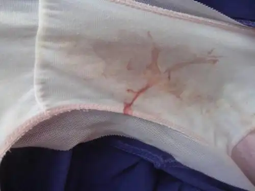 "排卵期出血"究竟怎么回事?到底是该补充孕酮还是雌激素?