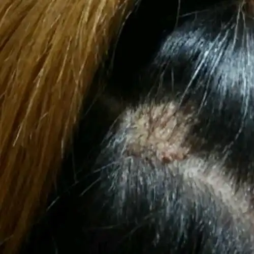 头皮上长这个东西是什么?