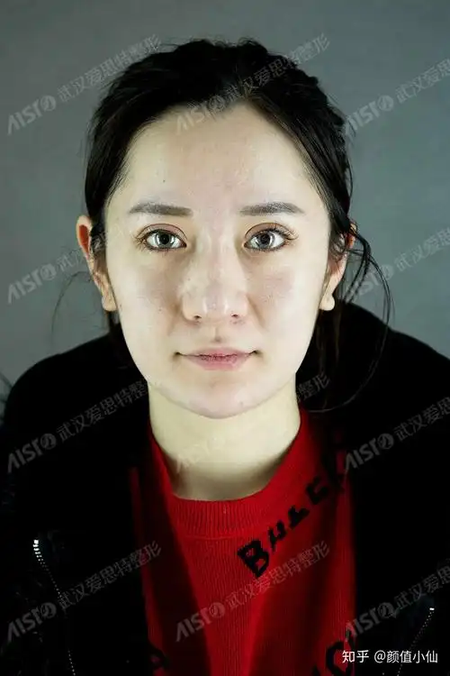 鼻翼宽or鼻骨宽你会判断吗