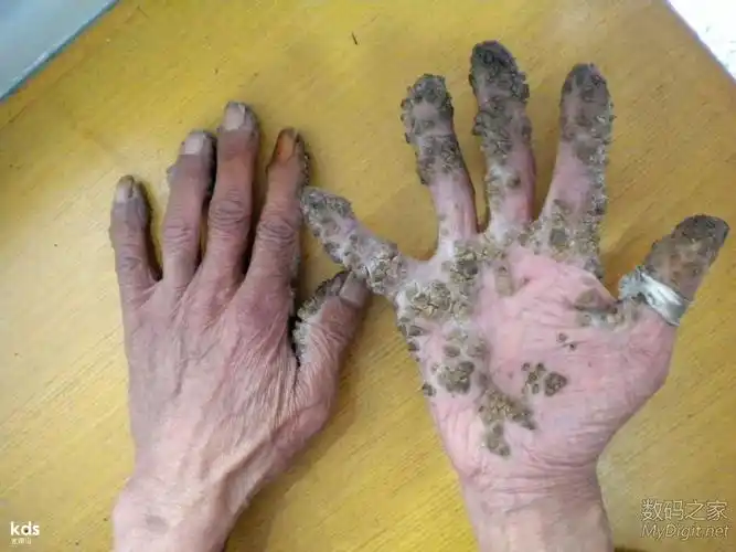 [ios]密集恐惧症