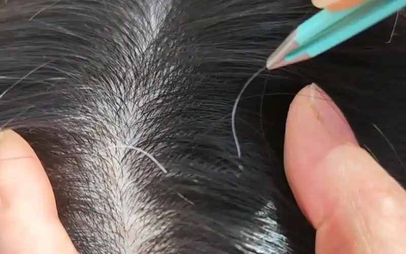 你拔过白头发吗?