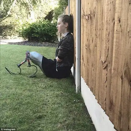 14岁蹦床冠军因病四肢截肢今成化妆女王还将成为赛车手