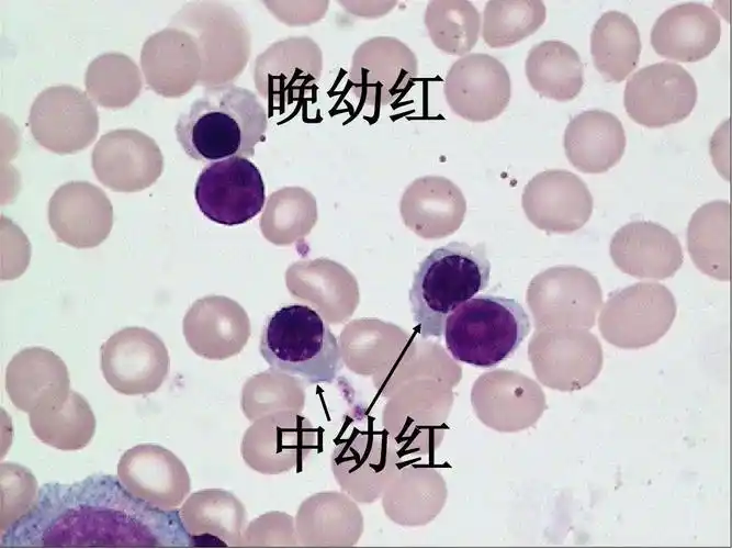 血细胞图谱大全ppt