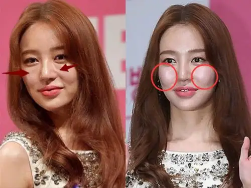 女明星脸僵的真正原因居然是