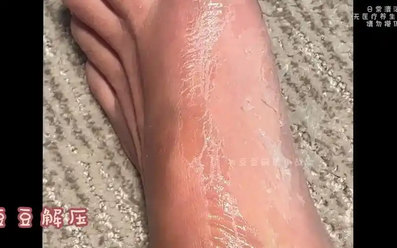 这个脚皮我看着怎么像胶水#脚皮 #解压 #助眠 #asmr #超级解压