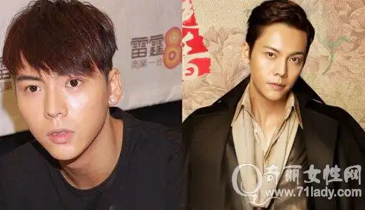 陈伟霆整容前后对比照