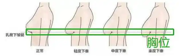 前面说了,胸位有高的,有低的,那乳房下垂就是在不改变胸位的