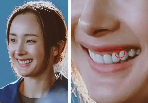 如何永肉眼识别明星们的假牙
