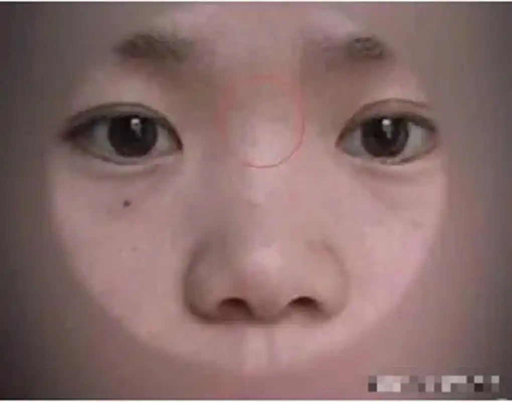 山根两旁为夫妻座,女人山根有横纹,表示性格比较极端,做事比较冲动