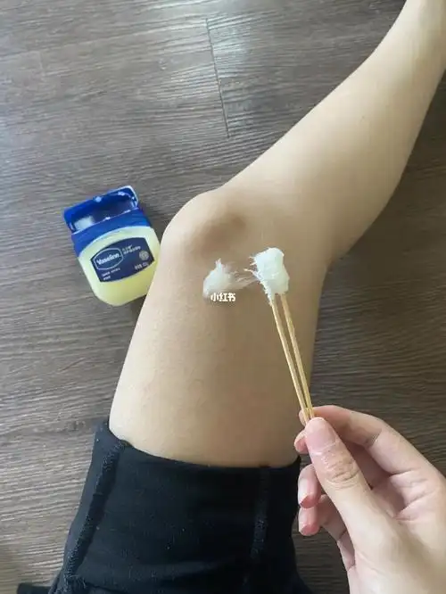 大腿上的纹终于给我抹下去了