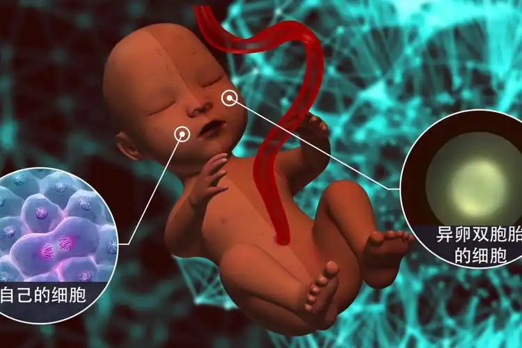 美女模特"吃"了她的双胞胎?3d揭为何她有两组dna