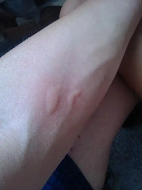 请问,我的皮肤怎么了.